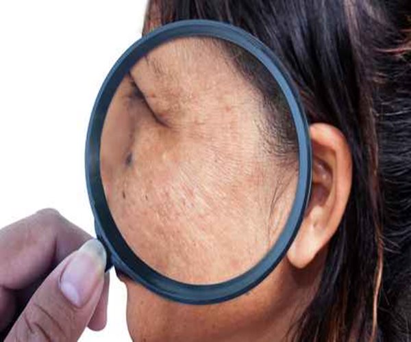 New 'Second Skin' Temporarily Smooths Wrinkles