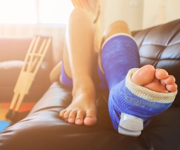 person laying on couch with leg in a cast