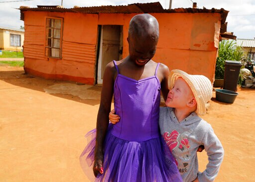 AP PHOTOS: South African Family Worries over Children's Fate