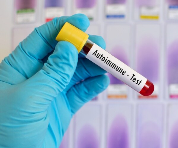 blood test for autoimmune disease