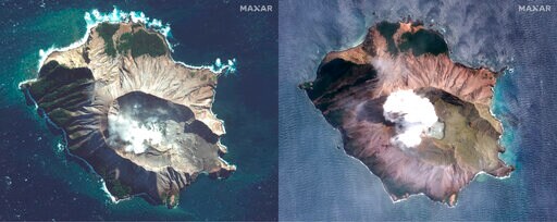 New Zealand Hospitals Order Skin to Treat Volcano Survivors