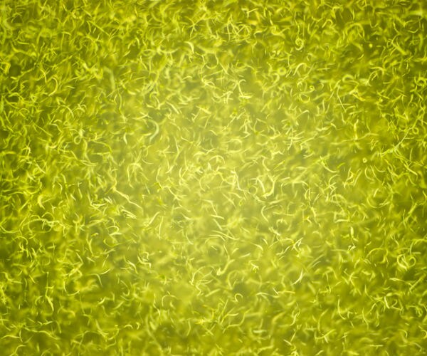 Warming Drives Spread of Toxic Algae in US, Researchers Say