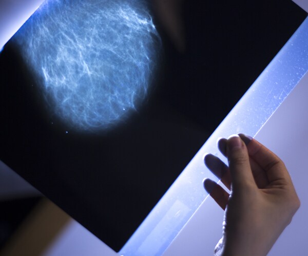 a hand holding a scan from a women's mammogram