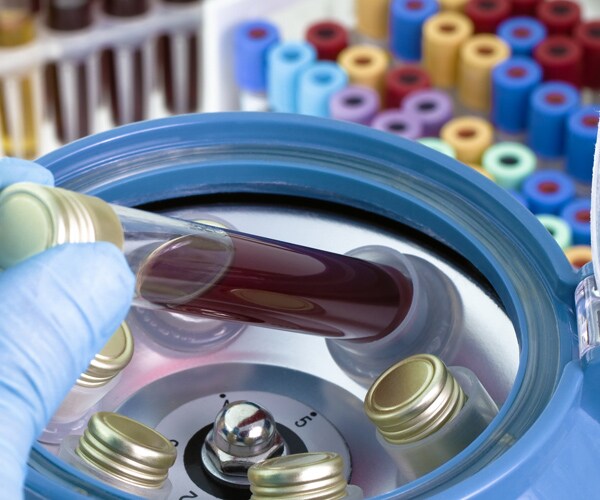 Malaria Drug May Fight Cancer; Clinical Trial Started ASAP