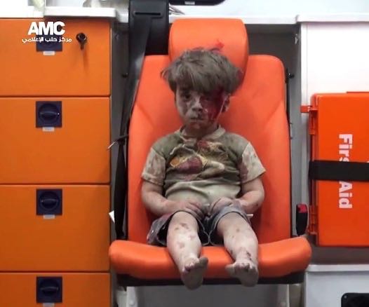 Brother of Omran, Syrian Boy in Haunting Picture, Dies of Wounds