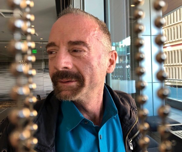 researchers are reporting a second patient has lived 18 months after stopping hiv treatment without sign of the virus.