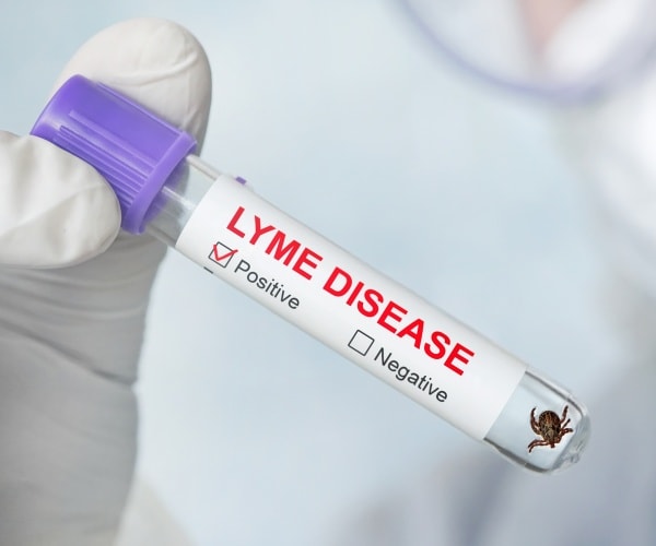 blood in vial positive for Lyme disease