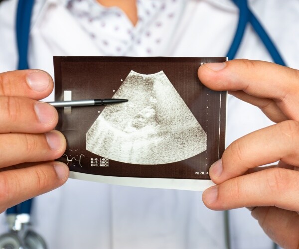 doctor pointing out liver in liver ultrasound