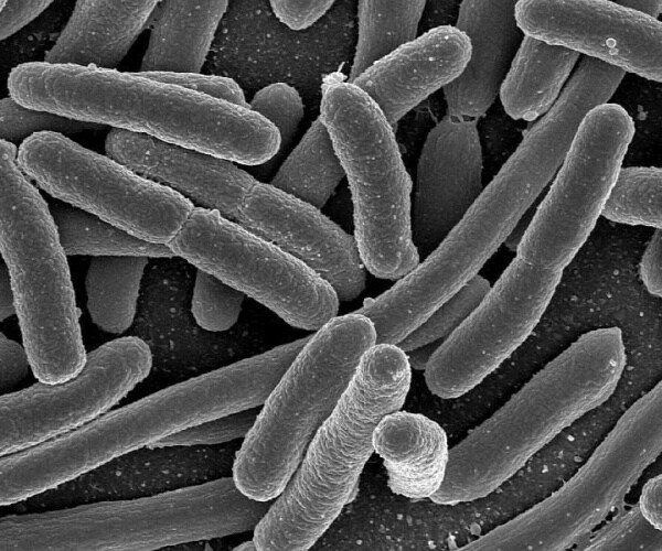 e. coli bacteria under microscope