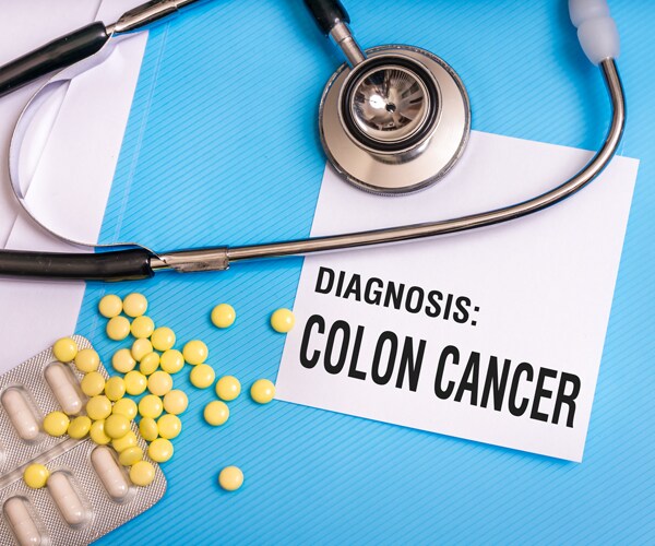 Colon cancer