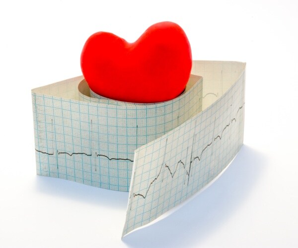 a red foam heart on top of paper readout of irregular heart rhythm electrocardiogram