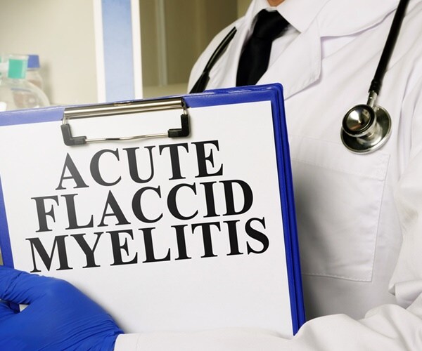 a doctor holds a clipboard that says acute flaccid myelitis