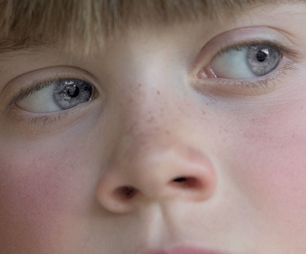 Scientists Find New Antibiotic in Human Nose