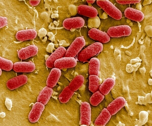 microscopic view of superbugs