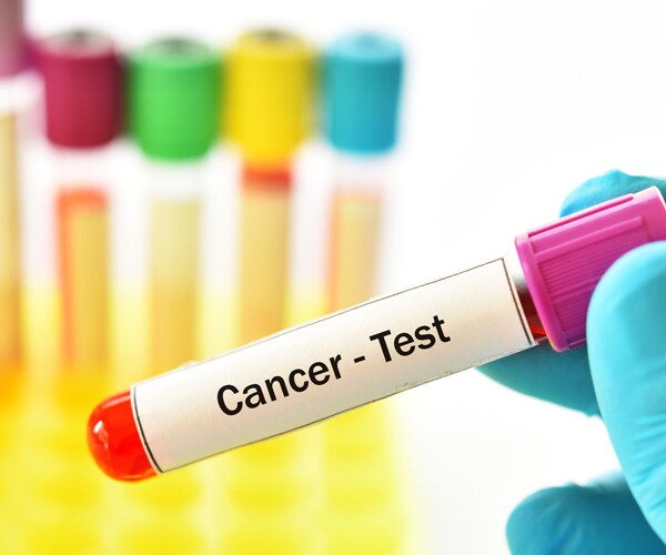 a cancer blood test