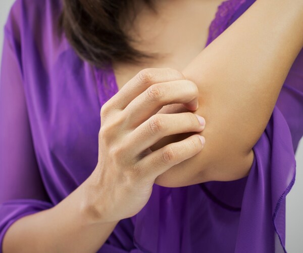 a woman scratching her elbow