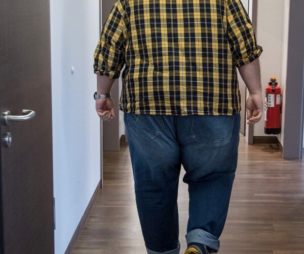 a man arrives for his first post-op examination at the german obesity center after weight loss surgery. 