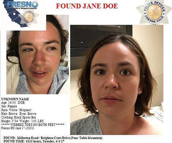 Woman's a Mermaid: Unidentified Girl With Webbed Toes Makes Wild Claim