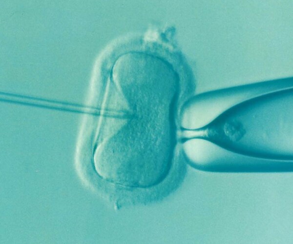 ivf procedure in lab