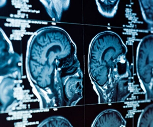 images from brain scan