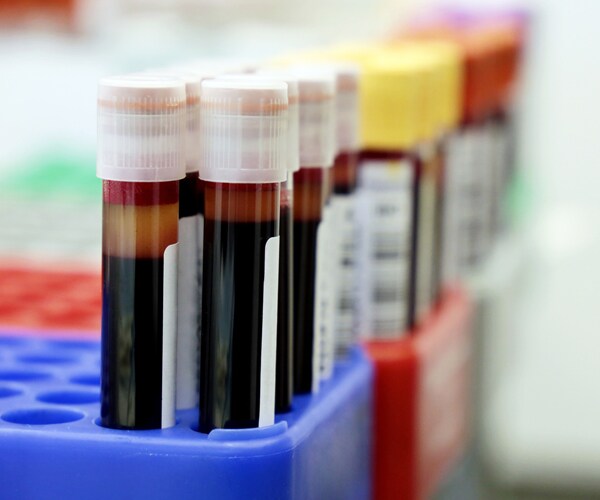 vials of blood in a lab