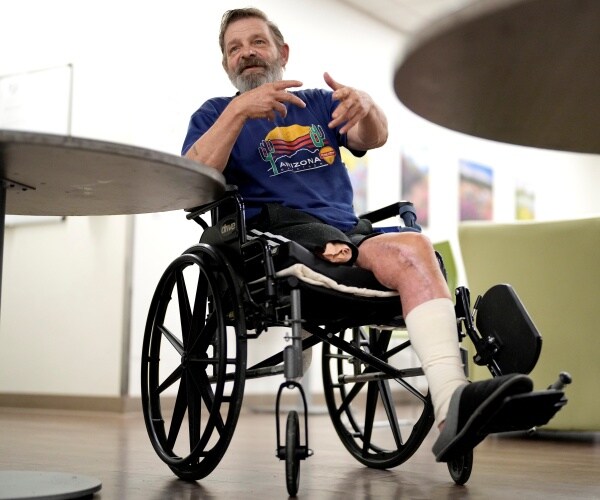 Ron Falk, 62, speaks of losing his leg after falling on burning pavement in Phoenix.