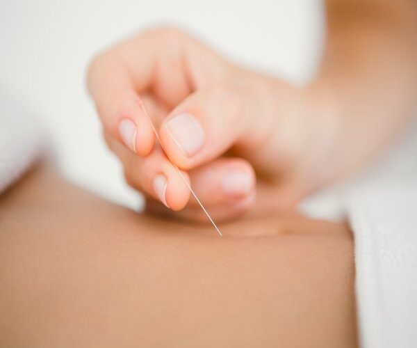Acupuncture Reduces Hot Flashes in 50 Percent of Women 