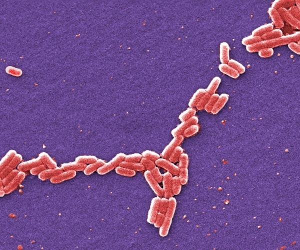 microscopic view of e. coli