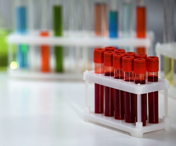 blood samples in a medical lab
