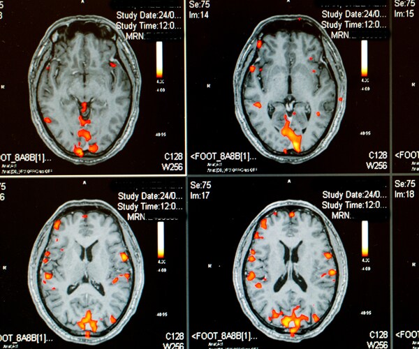 brain scans