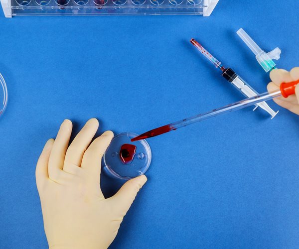 Drugmaker Looks to Patients' Blood for COVID-19 Treatment