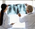 Early-Stage Lung Cancer Surgery Safe Over 80
