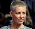 Evangeline Lilly Reveals Brain Damage Diagnosis After Fall