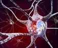 Biomarker Discovery Improves Dementia Diagnosis