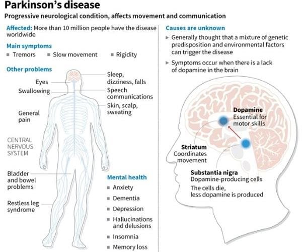 Japan Approves Stem-Cell Treatment for Parkinson's in World First