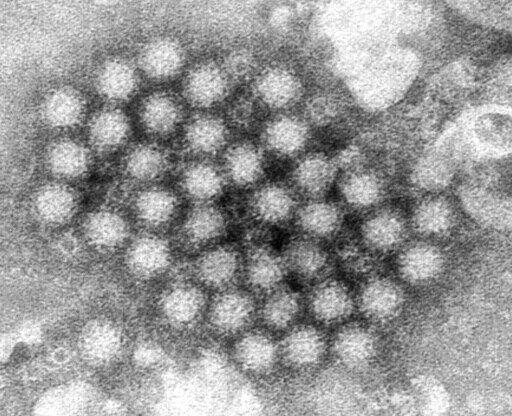 Nasty Norovirus Back in Full Force