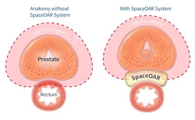 AugImage.jpg AugImage.jpg